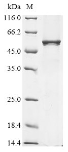(Tris-Glycine gel) Discontinuous SDS-PAGE (reduced) with 5% enrichment gel and 15% separation gel.