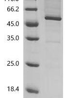 (Tris-Glycine gel) Discontinuous SDS-PAGE (reduced) with 5% enrichment gel and 15% separation gel.