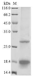 (Tris-Glycine gel) Discontinuous SDS-PAGE (reduced) with 5% enrichment gel and 15% separation gel.