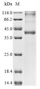 (Tris-Glycine gel) Discontinuous SDS-PAGE (reduced) with 5% enrichment gel and 15% separation gel.