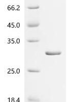 (Tris-Glycine gel) Discontinuous SDS-PAGE (reduced) with 5% enrichment gel and 15% separation gel.