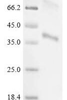 (Tris-Glycine gel) Discontinuous SDS-PAGE (reduced) with 5% enrichment gel and 15% separation gel.