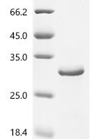(Tris-Glycine gel) Discontinuous SDS-PAGE (reduced) with 5% enrichment gel and 15% separation gel.
