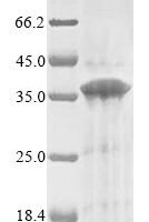 (Tris-Glycine gel) Discontinuous SDS-PAGE (reduced) with 5% enrichment gel and 15% separation gel.