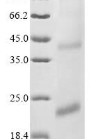 (Tris-Glycine gel) Discontinuous SDS-PAGE (reduced) with 5% enrichment gel and 15% separation gel.