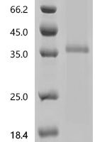 (Tris-Glycine gel) Discontinuous SDS-PAGE (reduced) with 5% enrichment gel and 15% separation gel.