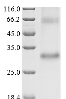 (Tris-Glycine gel) Discontinuous SDS-PAGE (reduced) with 5% enrichment gel and 15% separation gel.