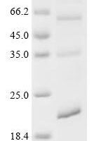 (Tris-Glycine gel) Discontinuous SDS-PAGE (reduced) with 5% enrichment gel and 15% separation gel.