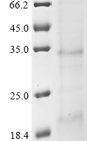 (Tris-Glycine gel) Discontinuous SDS-PAGE (reduced) with 5% enrichment gel and 15% separation gel.