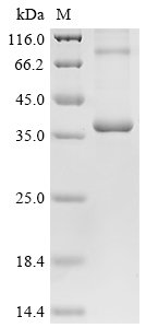 (Tris-Glycine gel) Discontinuous SDS-PAGE (reduced) with 5% enrichment gel and 15% separation gel.