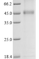 (Tris-Glycine gel) Discontinuous SDS-PAGE (reduced) with 5% enrichment gel and 15% separation gel.