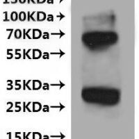 (Tris-Glycine gel) Discontinuous SDS-PAGE (reduced) with 5% enrichment gel and 15% separation gel.