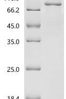 (Tris-Glycine gel) Discontinuous SDS-PAGE (reduced) with 5% enrichment gel and 15% separation gel.