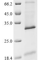 (Tris-Glycine gel) Discontinuous SDS-PAGE (reduced) with 5% enrichment gel and 15% separation gel.