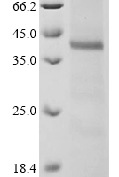 (Tris-Glycine gel) Discontinuous SDS-PAGE (reduced) with 5% enrichment gel and 15% separation gel.