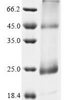 (Tris-Glycine gel) Discontinuous SDS-PAGE (reduced) with 5% enrichment gel and 15% separation gel.