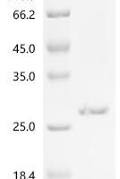 (Tris-Glycine gel) Discontinuous SDS-PAGE (reduced) with 5% enrichment gel and 15% separation gel.
