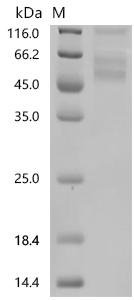 (Tris-Glycine gel) Discontinuous SDS-PAGE (reduced) with 5% enrichment gel and 15% separation gel.