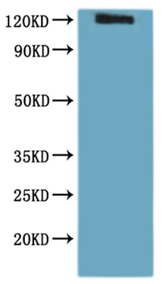 CSB-MP021527HU(A4) is detected by Mouse anti-6*His monoclonal antibody.