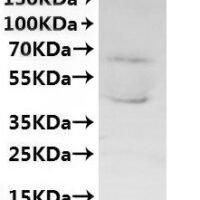 CSB-MP6057CXP1 is detected by Mouse anti-6*His monoclonal antibody.