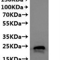 CSB-MP6057CXP is detected by Mouse anti-6*His monoclonal antibody.