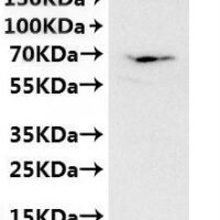 CSB-MP6057CXP(M) is detected by Mouse anti-6*His monoclonal antibody.