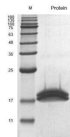 Recombinant Human Fibroblast Growth Factor 4 (FGF4) Protein, Active, Ultra-Low Endotoxin - Image 2