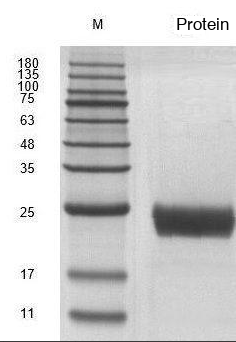 Recombinant Human Fibroblast Growth Factor 7 (FGF7) Protein, Active, Ultra-Low Endotoxin - Image 2
