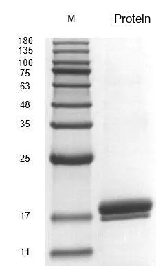 Recombinant Human Interleukin-2 (IL2) Protein, Active, Ultra-Low Endotoxin - Image 2