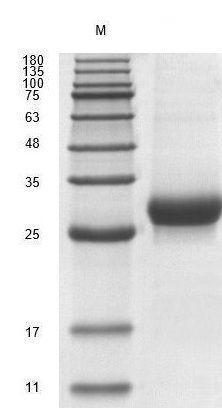 Recombinant Human Noggin (NOG) Protein, Active, Ultra-Low Endotoxin - Image 2