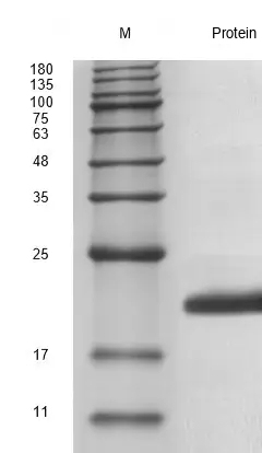 Recombinant Human Interleukin-21 (IL21) Protein, Active, Ultra-Low Endotoxin - Image 2