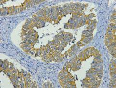 Mouse anti-Human/Mouse/Rat KRT19 Monoclonal Antibody