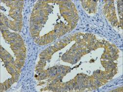Mouse anti-Human/Mouse/Rat KRT8 Monoclonal Antibody