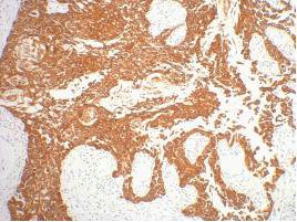Mouse anti-Human/Mouse/Rat KRT16 Monoclonal Antibody