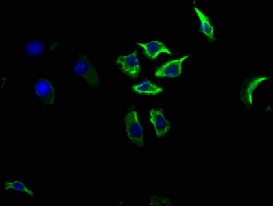 Mouse anti-Human/Mouse/Rat/Rabbit sapiens (Human) CD14 Monoclonal Antibody