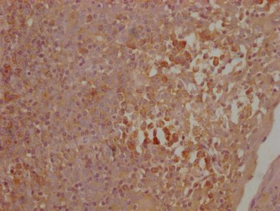 Mouse anti-Human sapiens (Human) CTLA4 Monoclonal Antibody