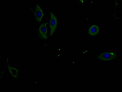 Mouse anti-Human sapiens (Human) EIF2AK3 Monoclonal Antibody