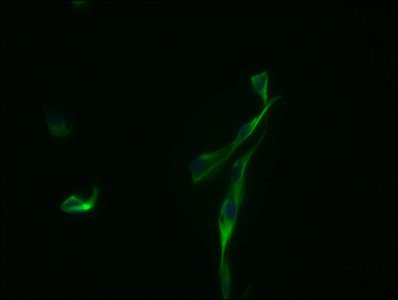 Mouse anti-Human sapiens (Human) GBP2 Monoclonal Antibody