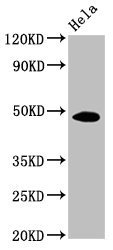 Mouse anti-Human sapiens (Human) MYC Monoclonal Antibody