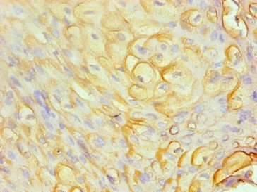 Mouse anti-Human sapiens (Human) S100A8 Monoclonal Antibody