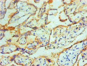 Mouse anti-Human sapiens (Human) TGM2 Monoclonal Antibody