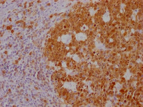 Mouse anti-Human sapiens (Human) POU2AF1 Monoclonal Antibody