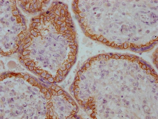 Mouse anti-Human sapiens (Human) CDH1 Monoclonal Antibody