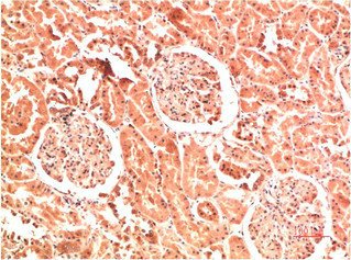 Mouse anti-Human/Mouse/Rat COL4A1 Monoclonal Antibody