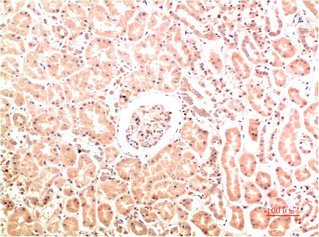 Mouse anti-Human/Mouse/Rat COL4A1 Monoclonal Antibody