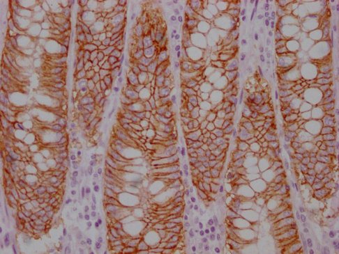 Mouse anti-Human sapiens (Human) EPCAM Monoclonal Antibody