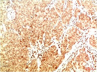Mouse anti-Human/Mouse/Rat Acetyl-RELA(K314/K315) Monoclonal Antibody