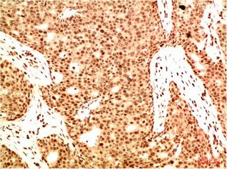 Mouse anti-Human/Mouse/Rat Acetyl-RELA(K314/K315) Monoclonal Antibody