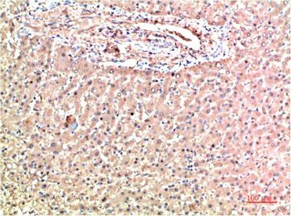 Mouse anti-Human TTR Monoclonal Antibody