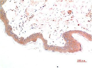 Mouse anti-Human/Mouse/Rat Phospho-SMAD3(S425) Monoclonal Antibody